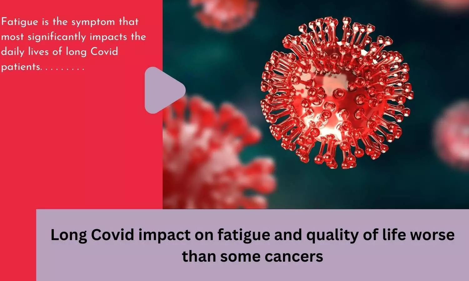Long Covid impact on fatigue and quality of life worse than some cancers