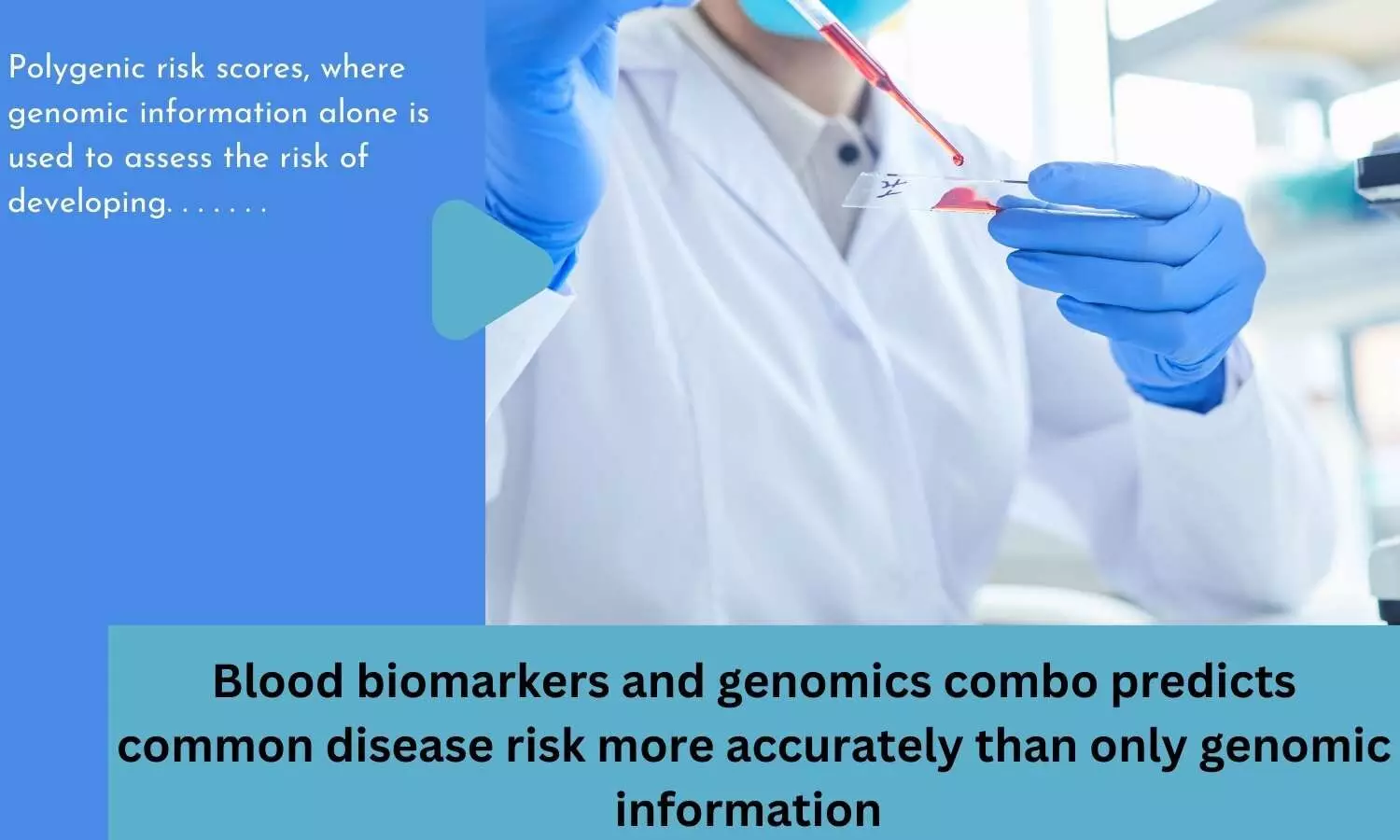 Blood biomarkers and genomics combo predicts common disease risk more accurately than only genomic information