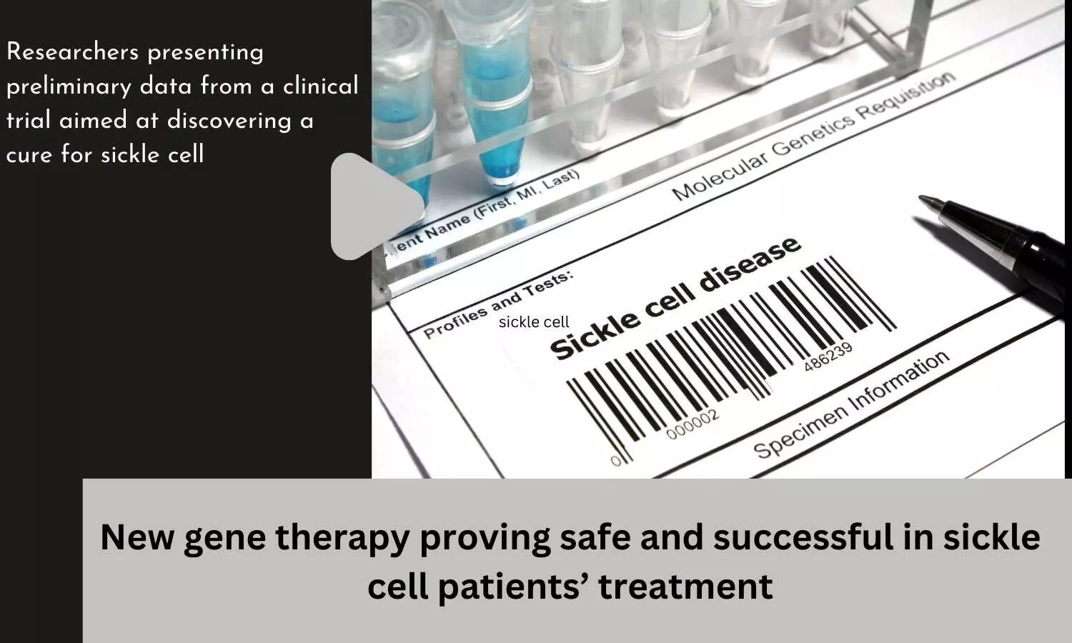 New gene therapy proving safe and successful in sickle cell patients treatment
