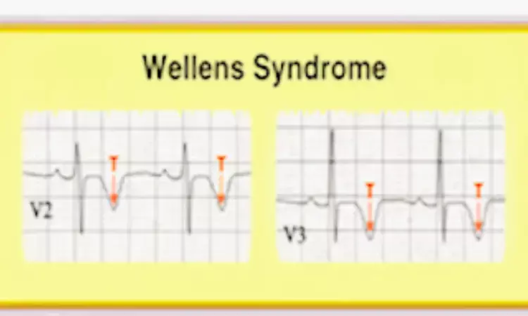 Rare Case of Wellens syndrome progressing from type A to classic type B Wellens pattern: A report