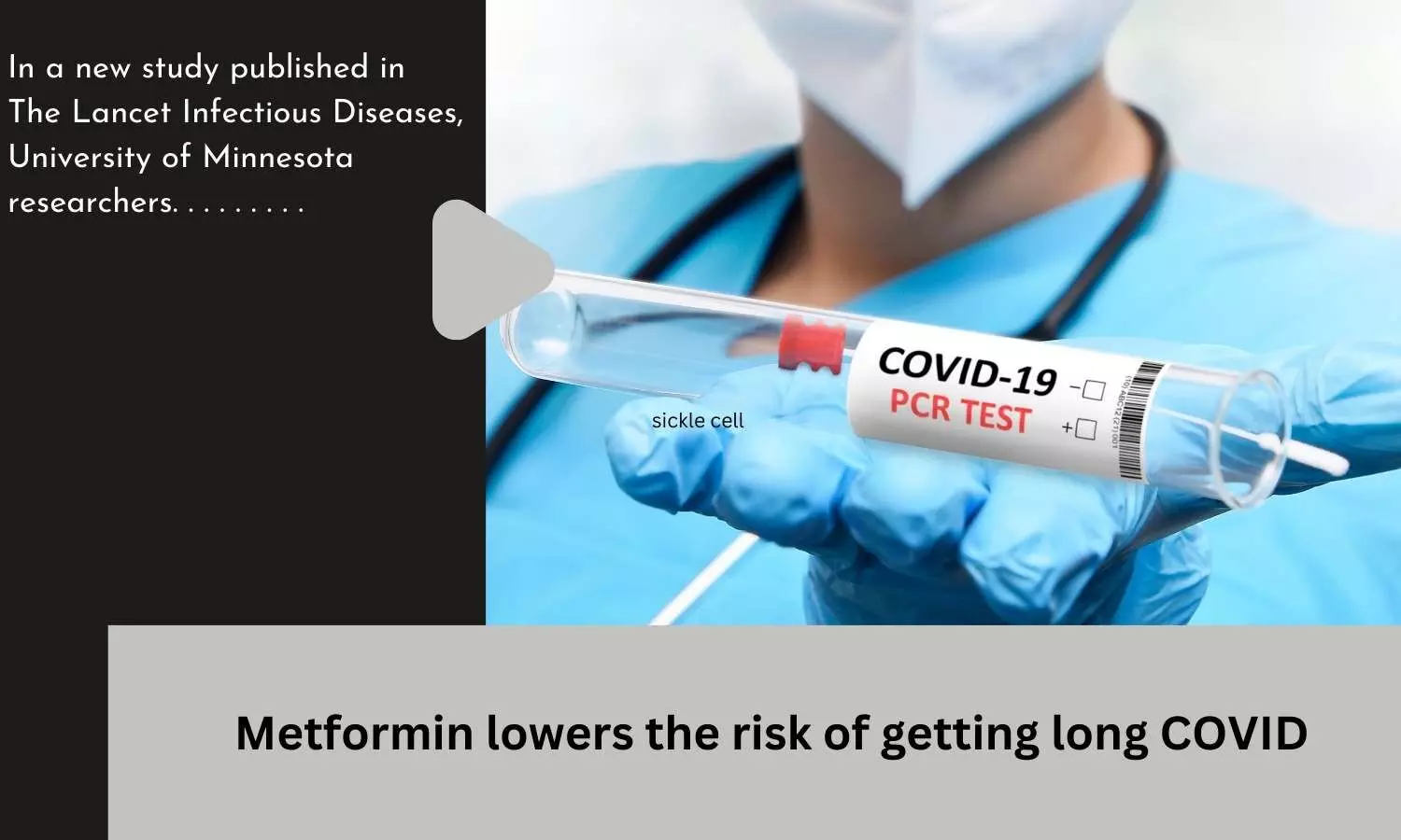 Metformin lowers the risk of getting long COVID