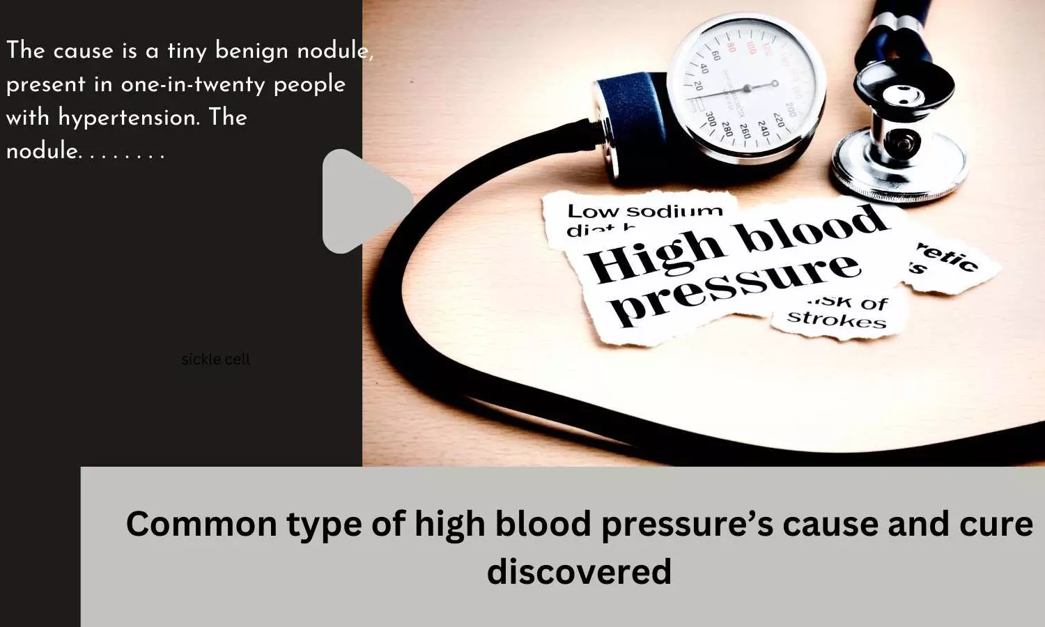 Common type of high blood pressures cause and cure discovered