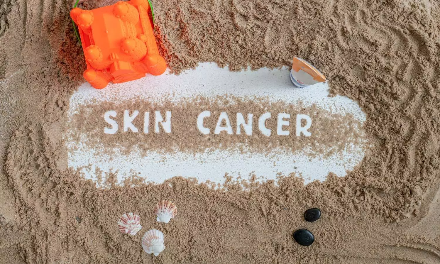 HCTZ-Linked Skin Cancer Risk Observed Primarily in White Patients: Study HCTZ-Linked Skin Cancer Risk Observed Primarily in White Patients: Study