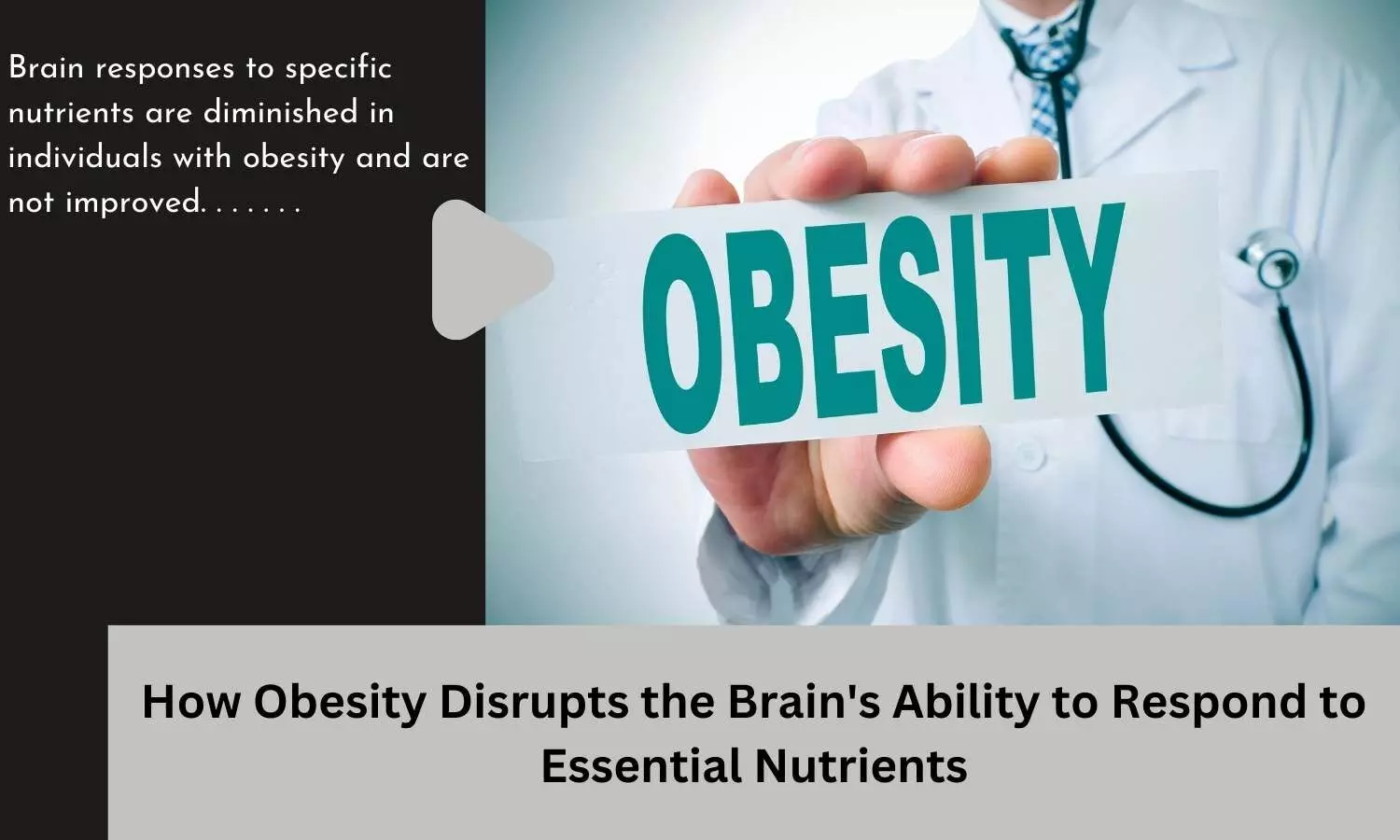 How Obesity Disrupts the Brains Ability to Respond to Essential Nutrients