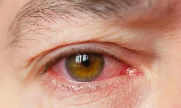 Increased Uveitis Recurrence Risk Observed After COVID-19 Vaccination: JAMA