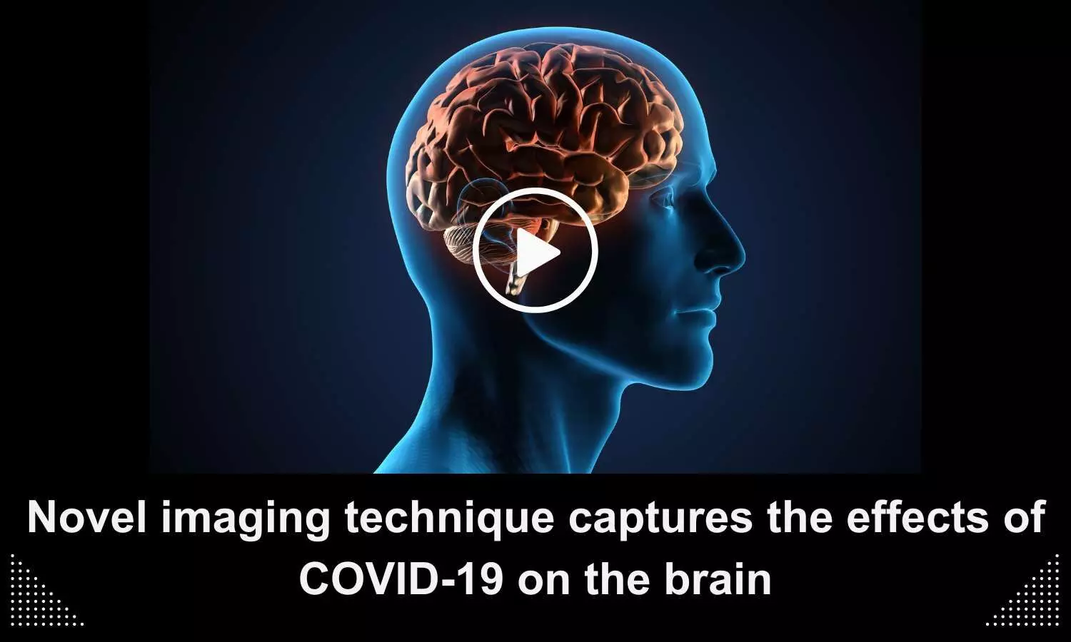 Novel imaging technique captures the effects of COVID-19 on the brain
