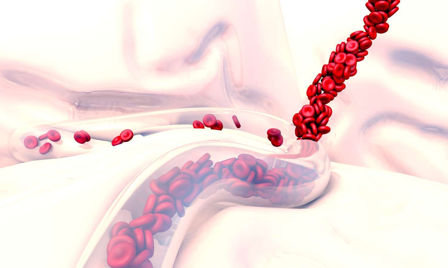 Prehospital Whole Blood Transfusion Offers No Survival Benefit versus Component Therapy in Traumatic Hemorrhage:  SWiFT Trial