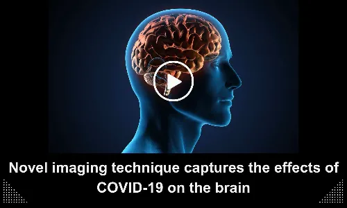 Novel imaging technique captures the effects of COVID-19 on the brain