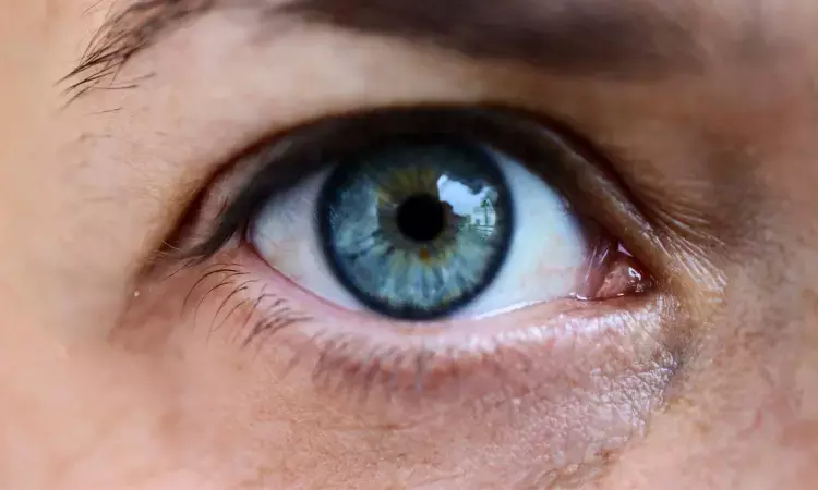 Ocular Surface Disease may be manifestation of GERD
