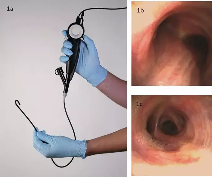 Single-use flexible bronchoscopes are non-inferior to  reusable flexible bronchoscopes