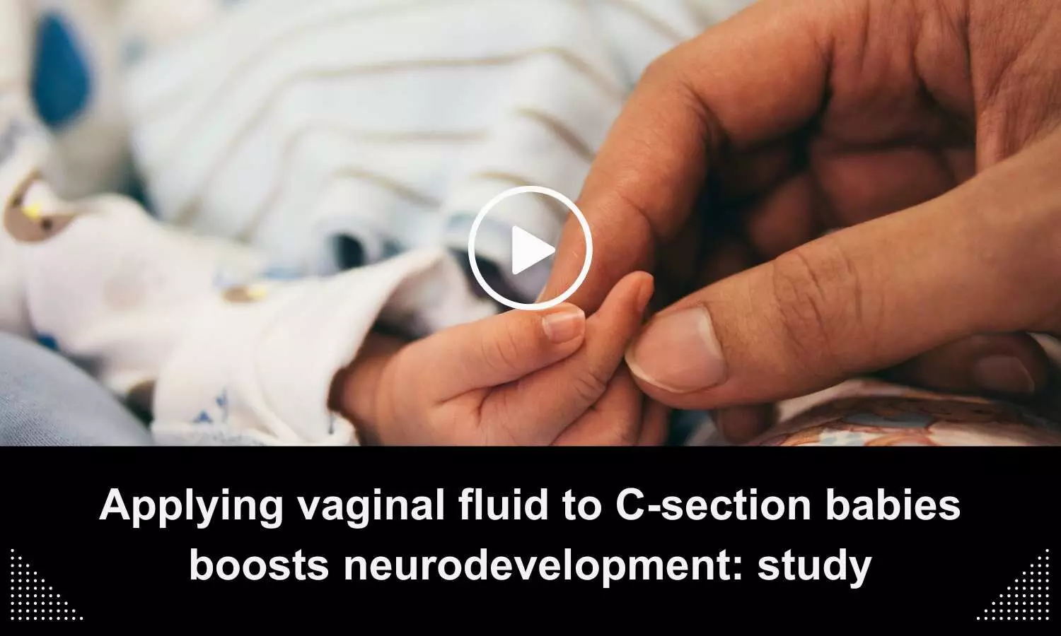 Applying vaginal fluid to C-section babies boosts neurodevelopment: study