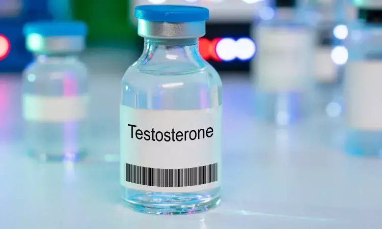 Urinary Iodine Concentration inversely and independently associated with testosterone levels