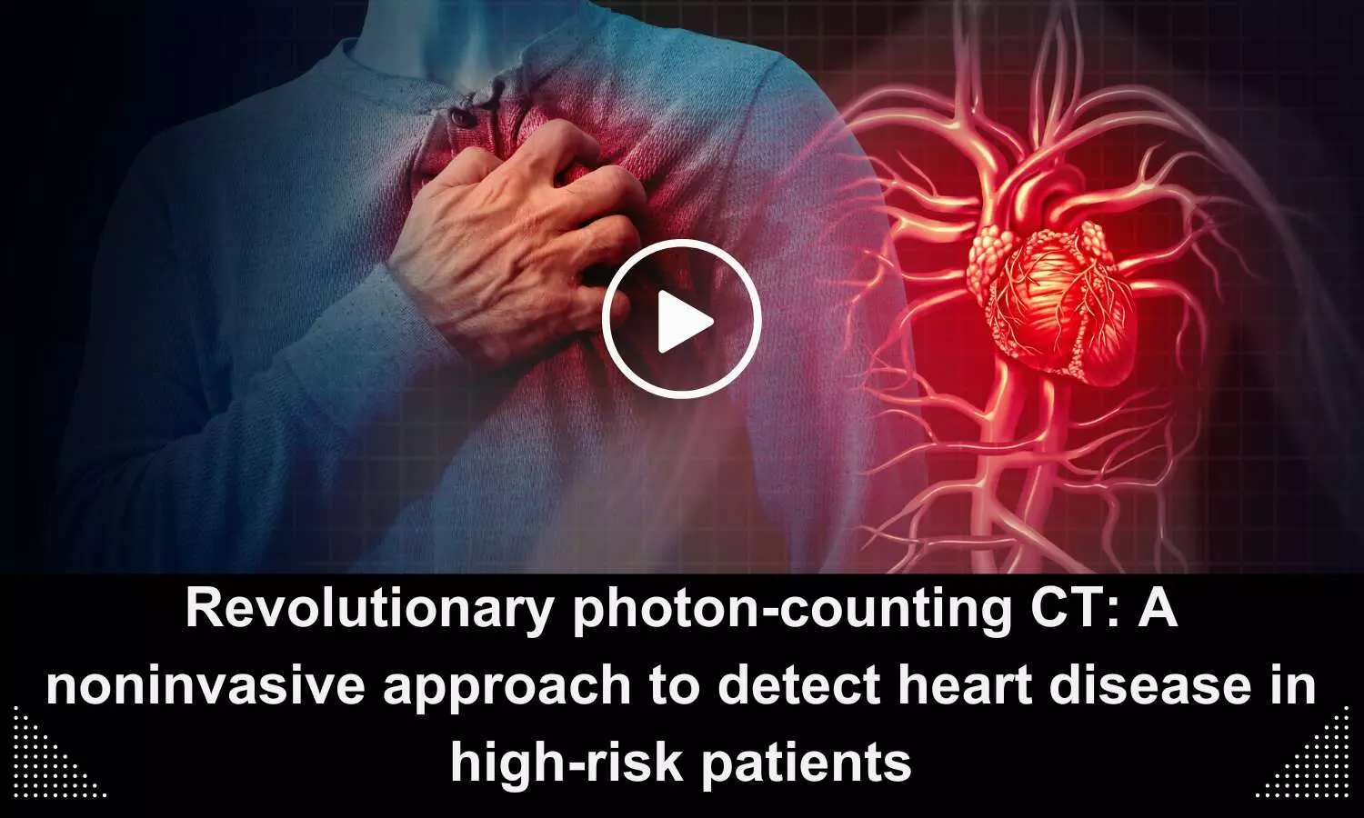 Revolutionary photon-counting CT: A noninvasive approach to detect heart disease in high-risk patients