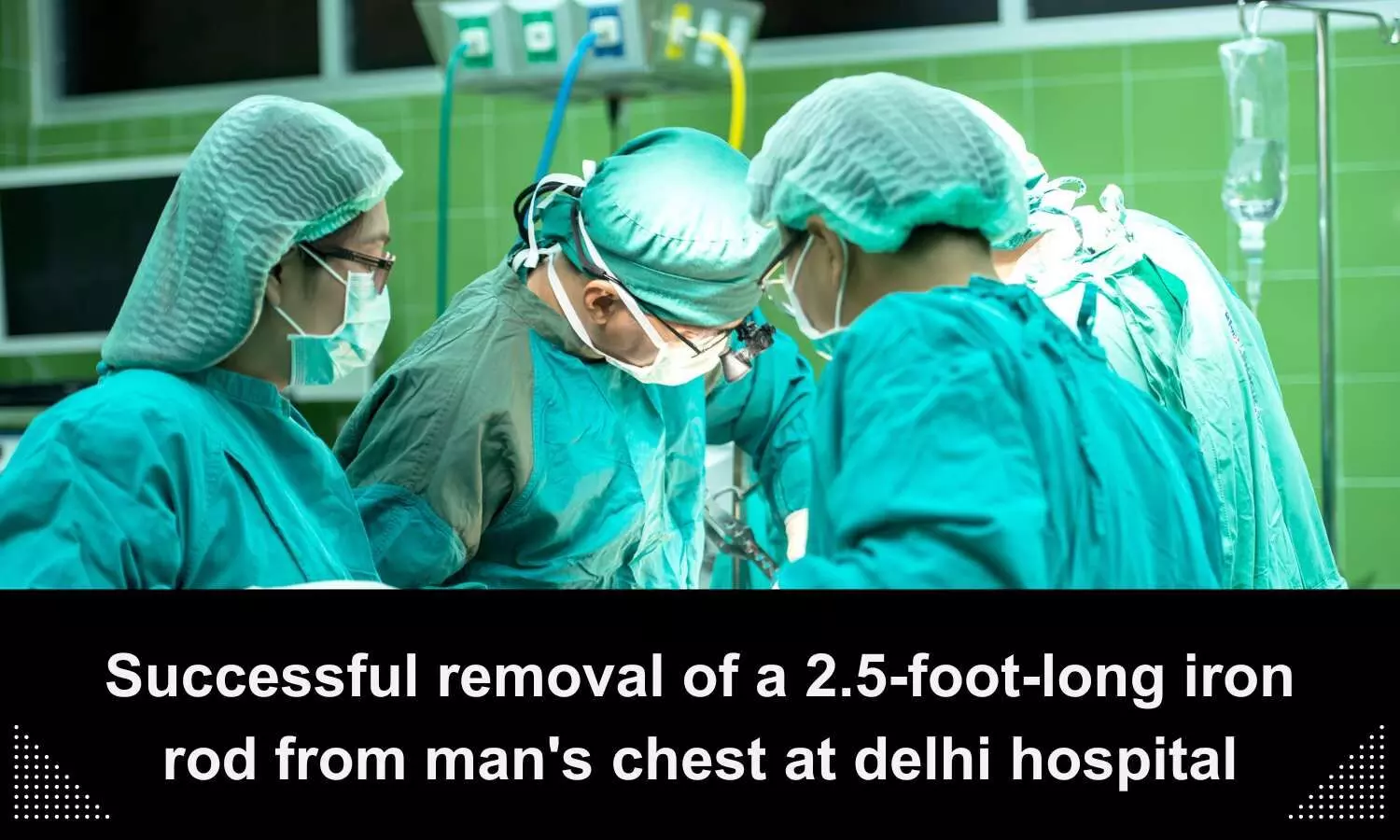 Max Superspeciality Hospital doctors successfully removes 2.5-foot-long iron rod from mans chest