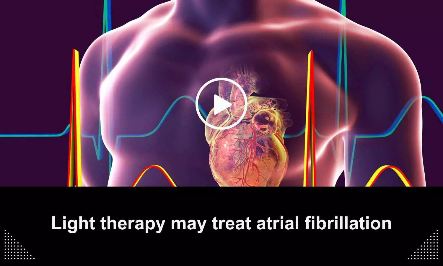 Light therapy may treat atrial fibrillation