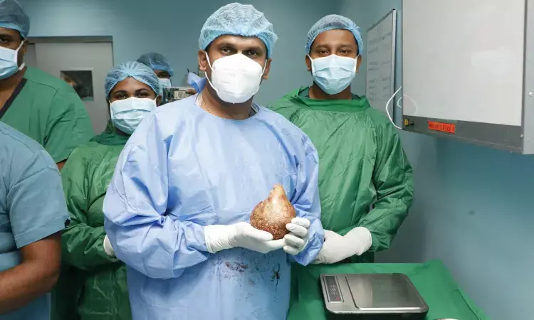 Worlds largest kidney stone weighing as much as five baseballs removed from man in Sri Lanka