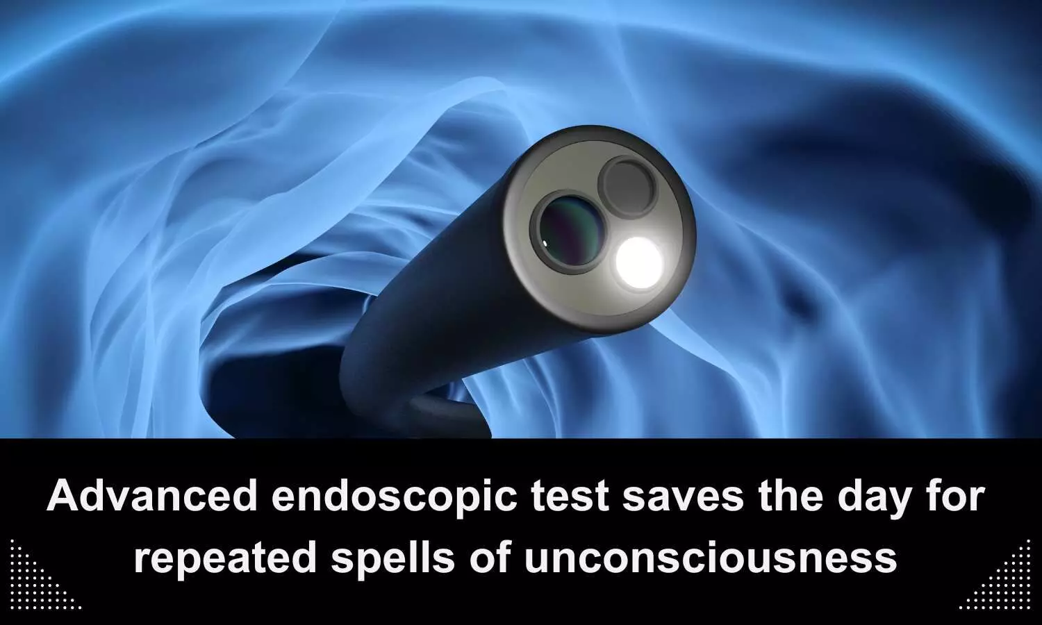 Advanced endoscopic test saves day for repeated spells of unconsciousness