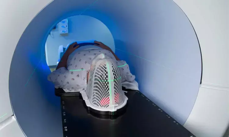 Mid-Treatment PET/CT Scans Show Promise in Predicting Xerostomia in Head and Neck Cancer Patients