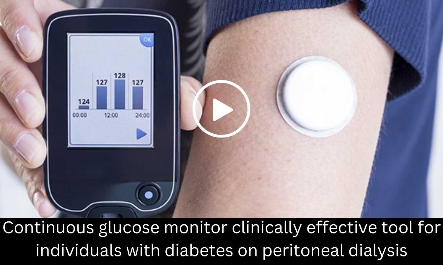 Continuous Glucose Monitor Clinically Effective Tool For Individuals 