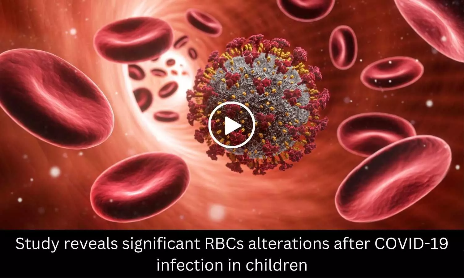Study reveals significant RBCs alterations after COVID-19 infection in children