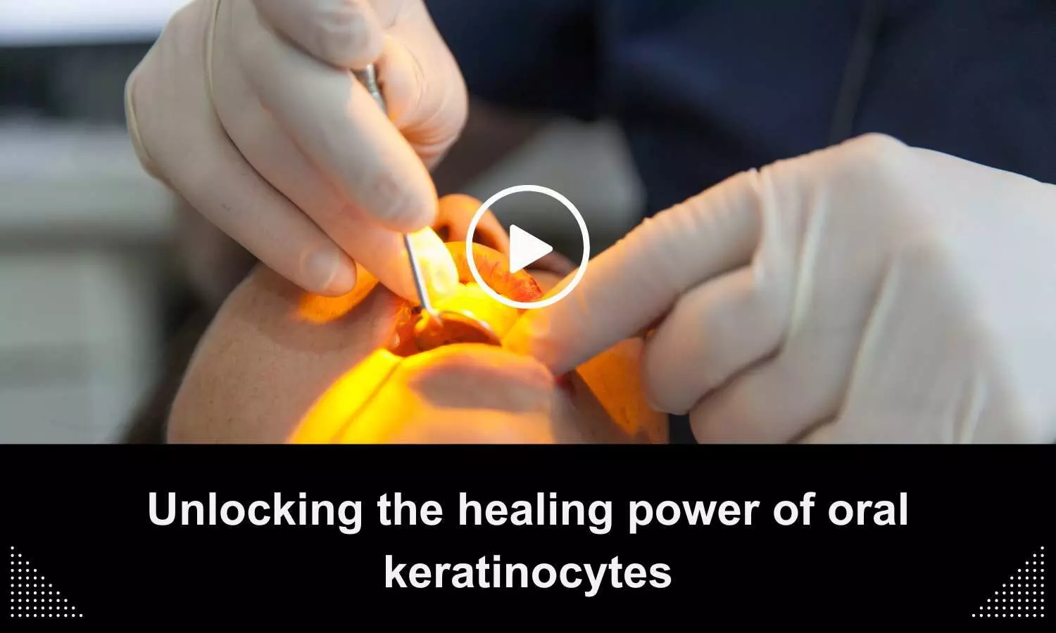 Unlocking the healing power of oral keratinocytes