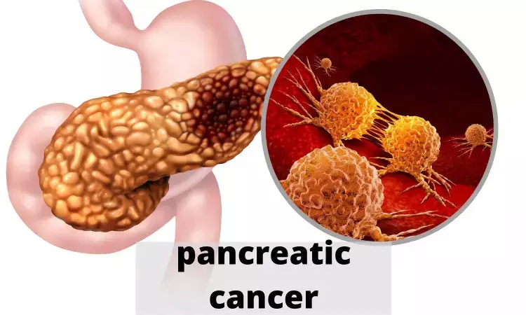 Study finds lower risk of pancreatic cancer if pancreatic cysts remain stable for five years