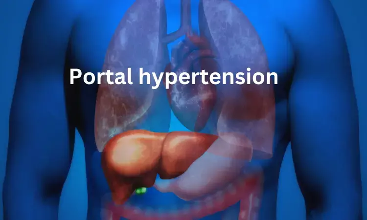Carvedilol more effective than non selective beta blockers in reducing portal hypertension