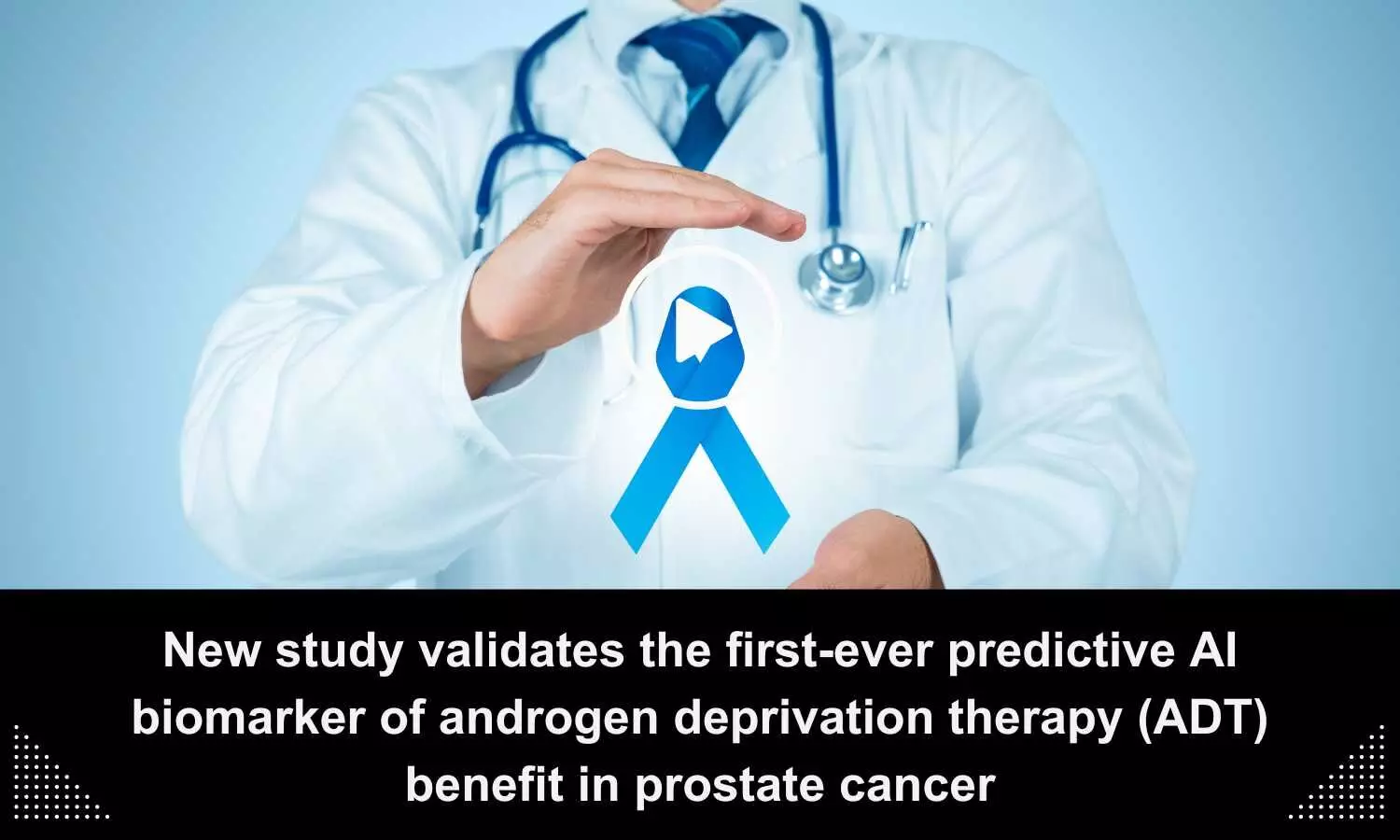 AI Unlocks Prostate Cancer Treatment Benefits