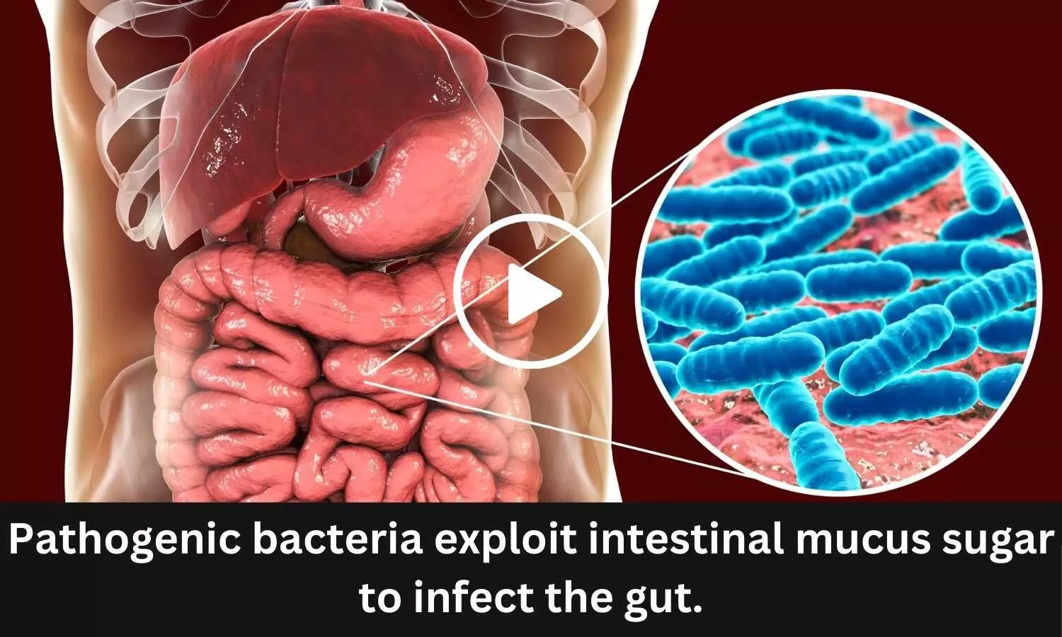 Pathogenic bacteria exploit intestinal mucus sugar to infect the gut.