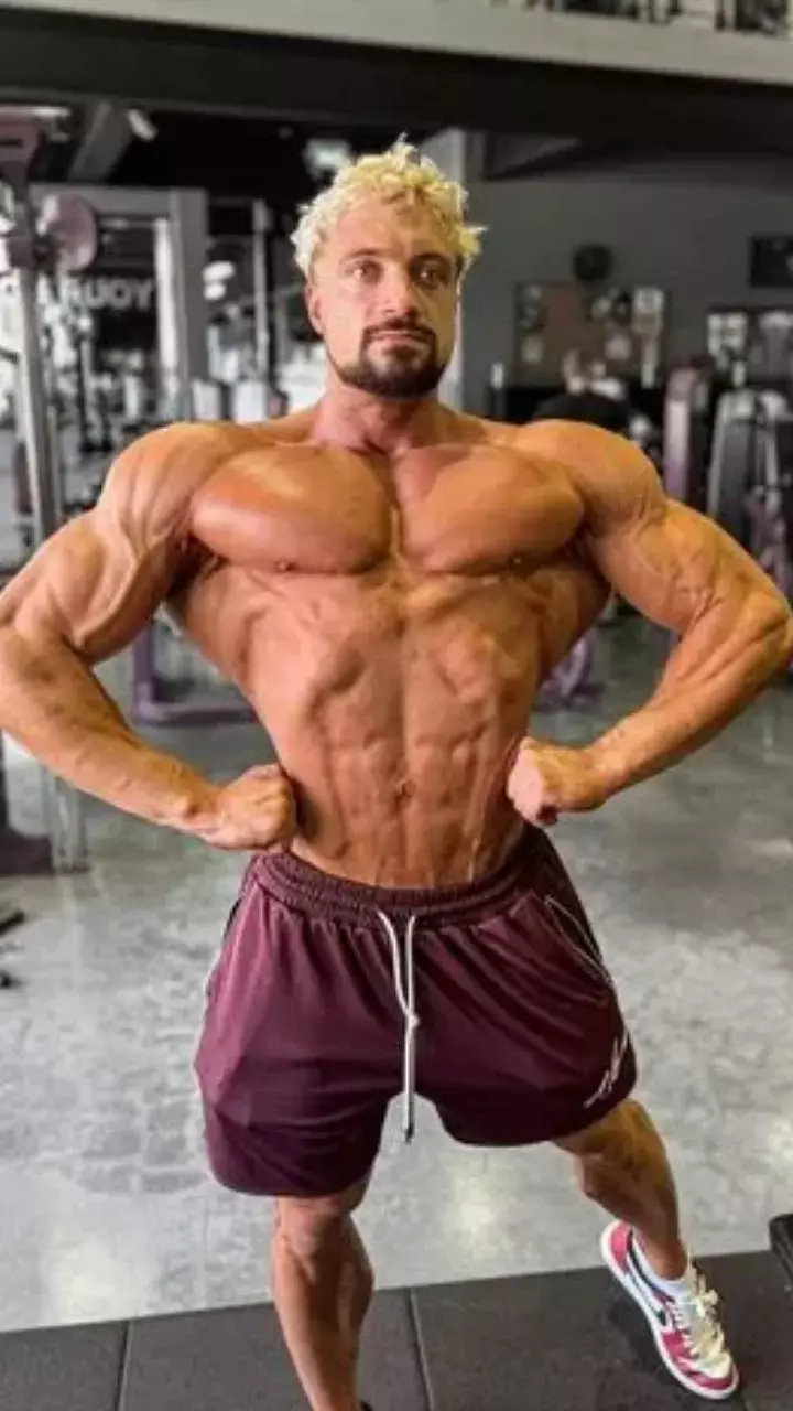 Know Aneurysm That Led To Bodybuilder Jo Lindner AKA Joestheticss Death