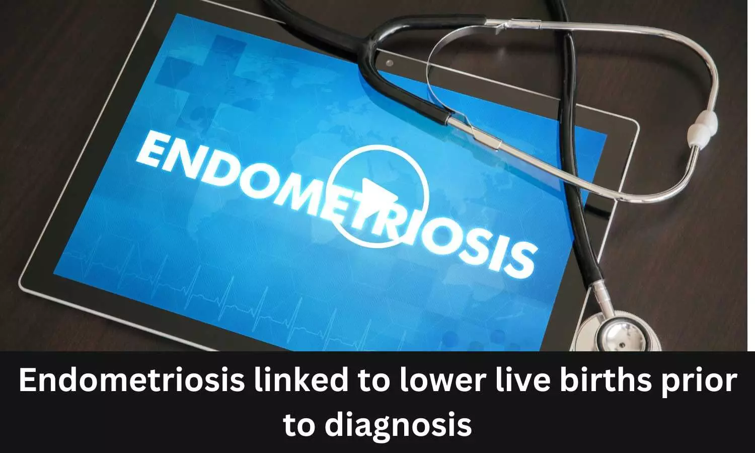 Endometriosis linked to lower live births prior to diagnosis