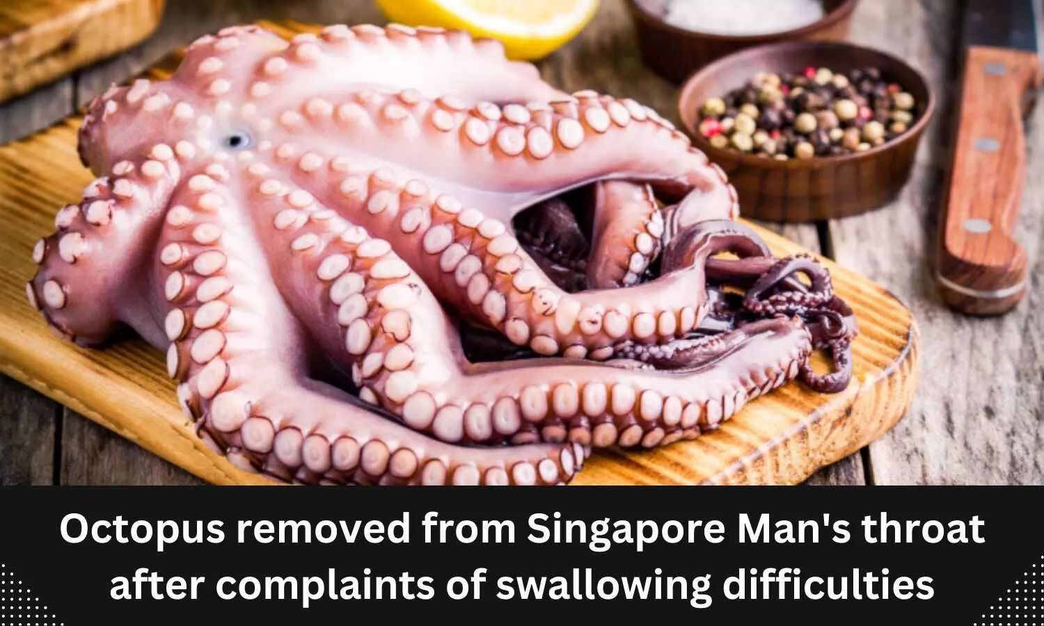 Doctors find octopus stuck in man's throat after he complained of