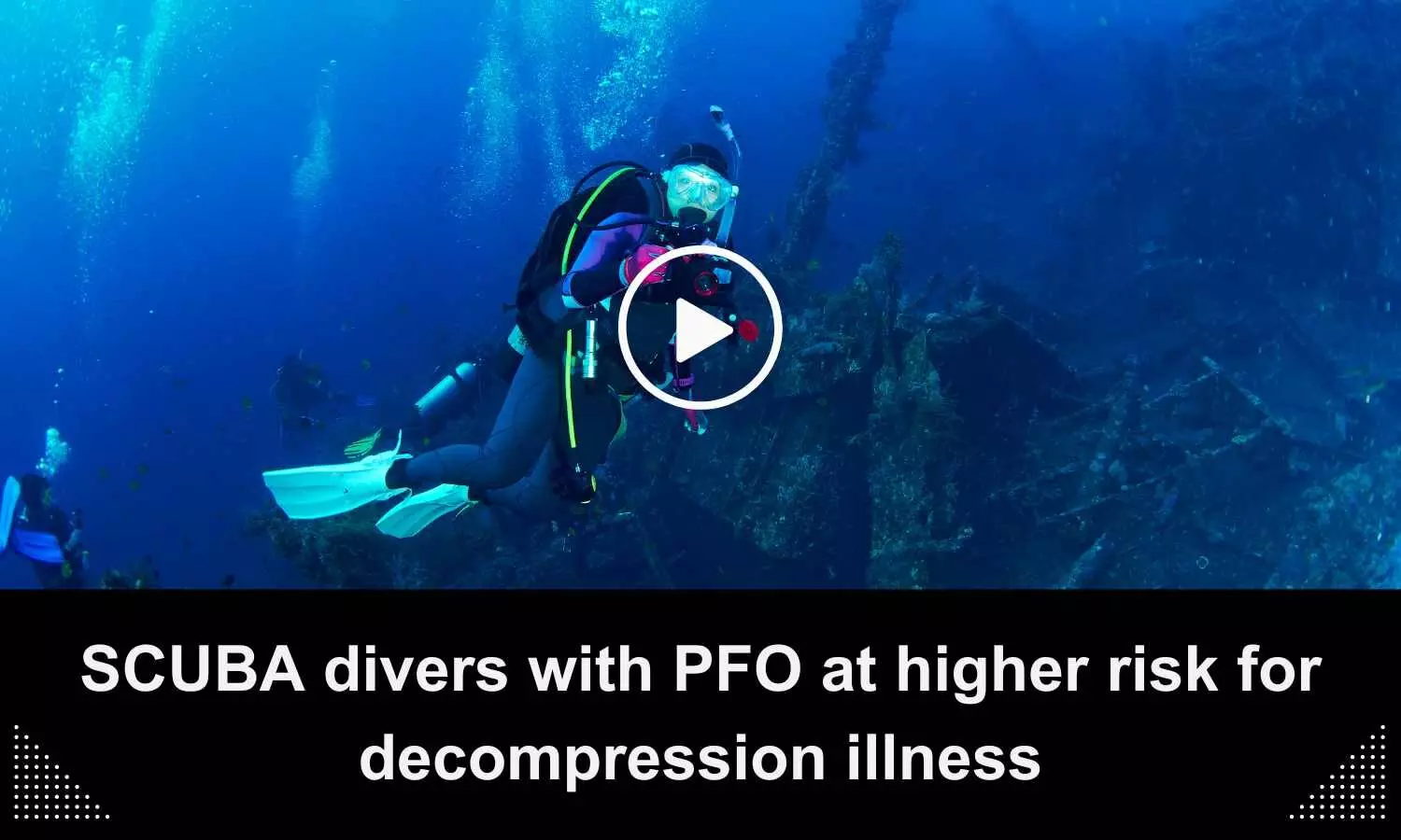 SCUBA divers with PFO at higher risk for decompression illness