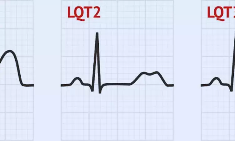 Trigger-specific syncope in Long QT syndrome tied to differential risk of  life-threatening events: JAMA