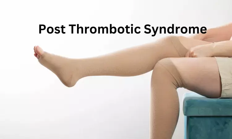 Elastic Compression Stockings foundation therapy for reducing risk of  post-thrombotic syndrome