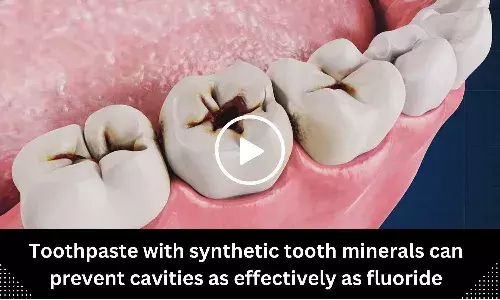 Toothpaste with synthetic tooth minerals can prevent cavities as effectively as fluoride