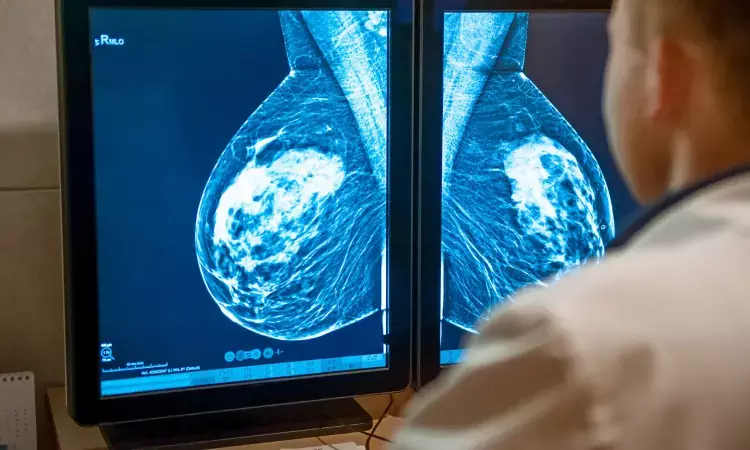 Dysregulation of lipid profile may increase risk of breast cancer in women with T2DM