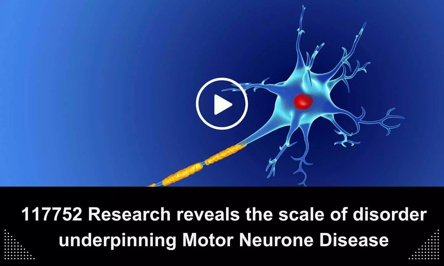 Research reveals the scale of disorder underpinning Motor Neurone Disease