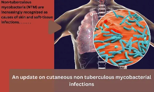 An update on cutaneous non tuberculous mycobacterial infections