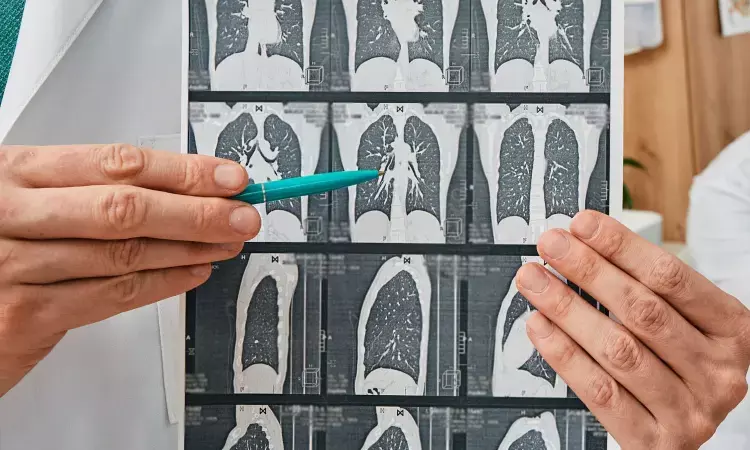 Radiologists outperformed AI in identifying lung diseases on chest X-ray