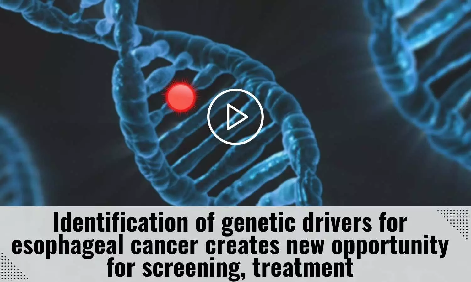 Identification of genetic drivers for esophageal cancer creates new opportunity for screening, treatment