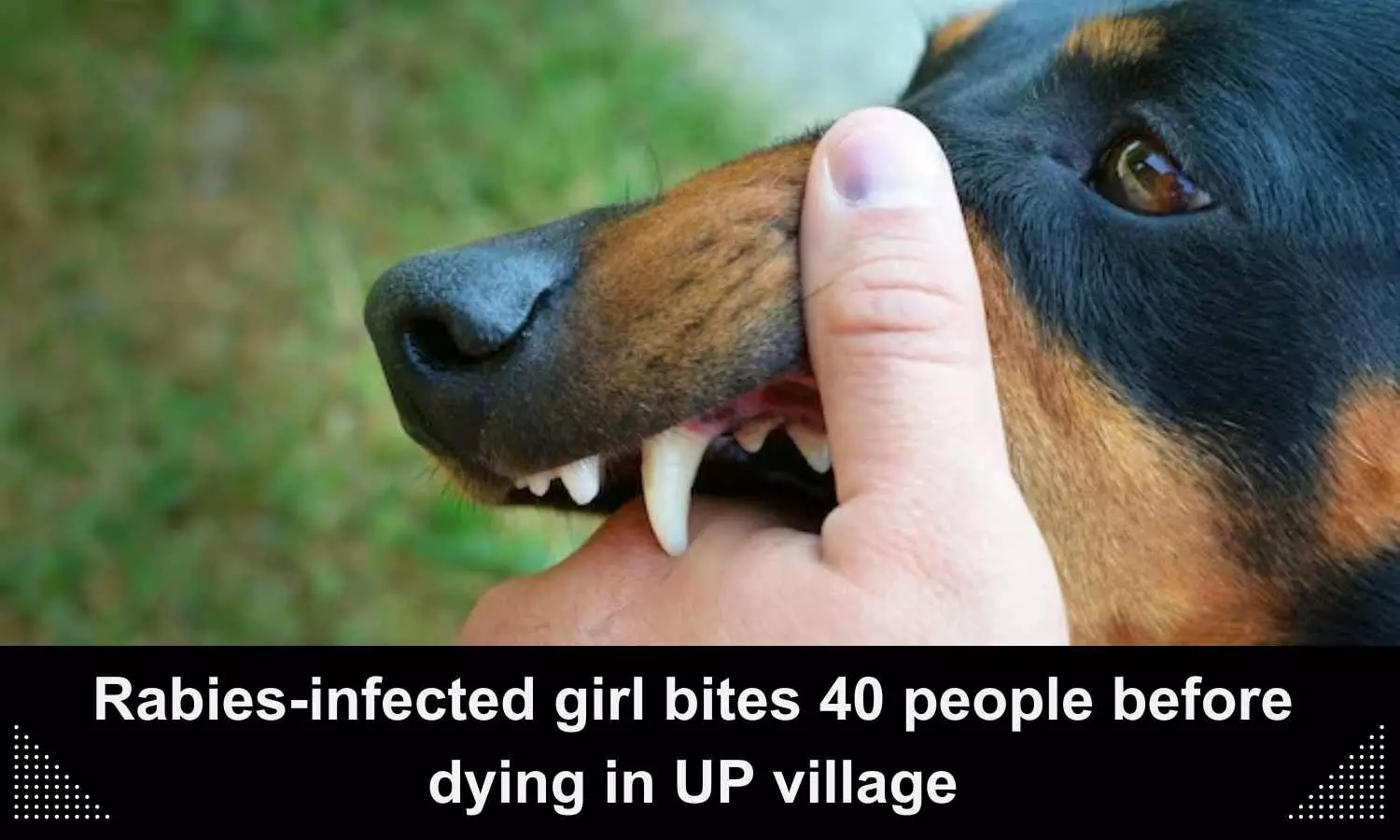 Rabies-infected girl bites 40 people before dying in UP village