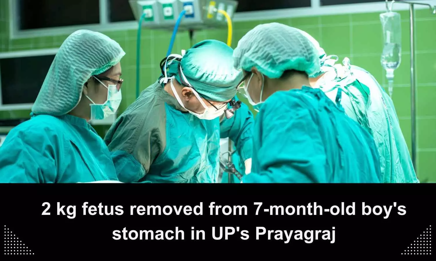 UP hospital doctors remove foetus from 7-month-old boys stomach
