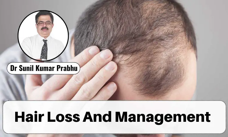 Understanding Hair Loss: Causes, Symptoms, Prevention And Management - Dr Sunil Kumar Prabhu