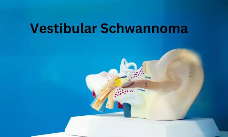 Upfront radiosurgery bests coservative approach for treating Vestibular Schwannomas: JAMA