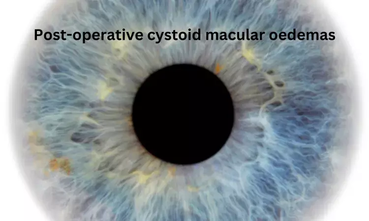 Triamcinolone: a potential first line treatment for post-surgical Cystoid Macular Oedema