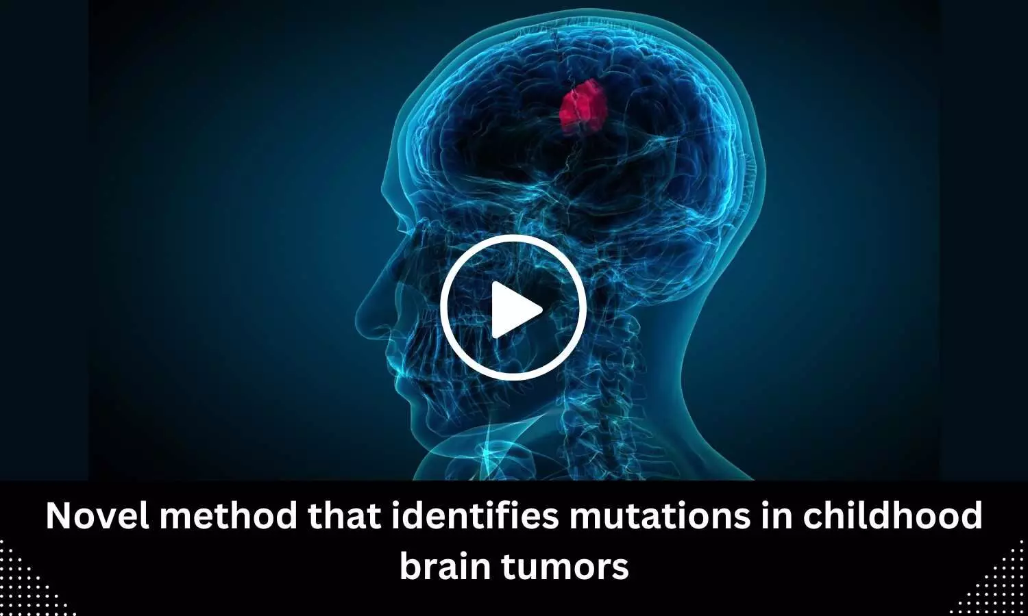 Novel method that identifies mutations in childhood brain tumors
