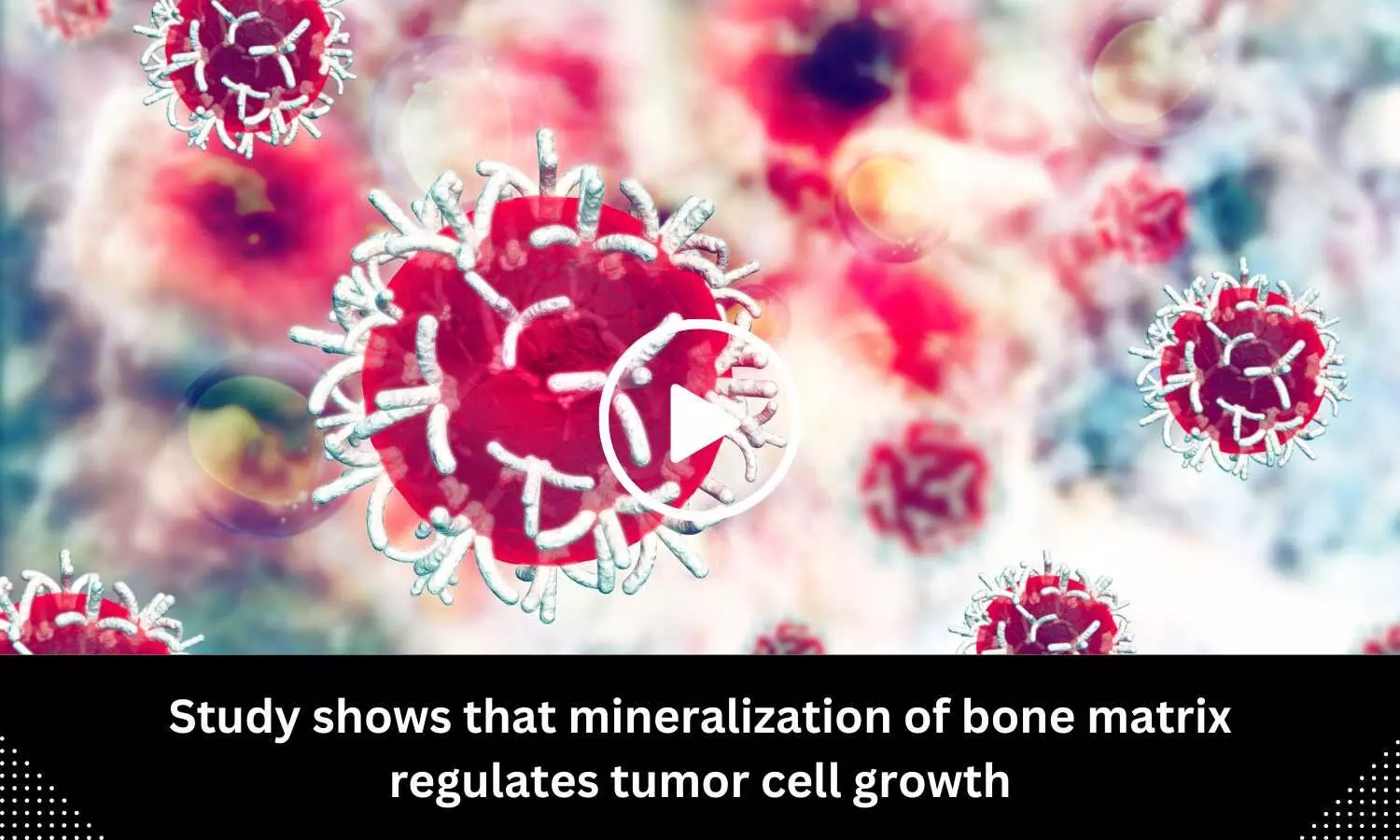 Study shows that mineralization of bone matrix regulates tumor cell growth