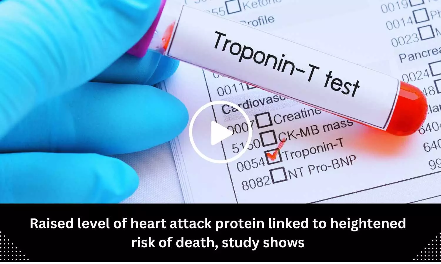 Raised level of heart attack protein linked to heightened risk of death, study shows