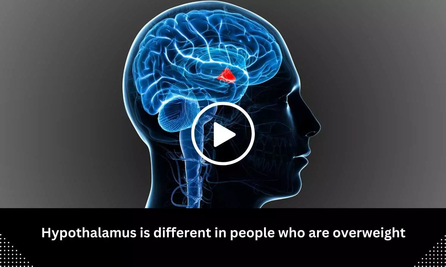 Hypothalamus is different in people who are overweight